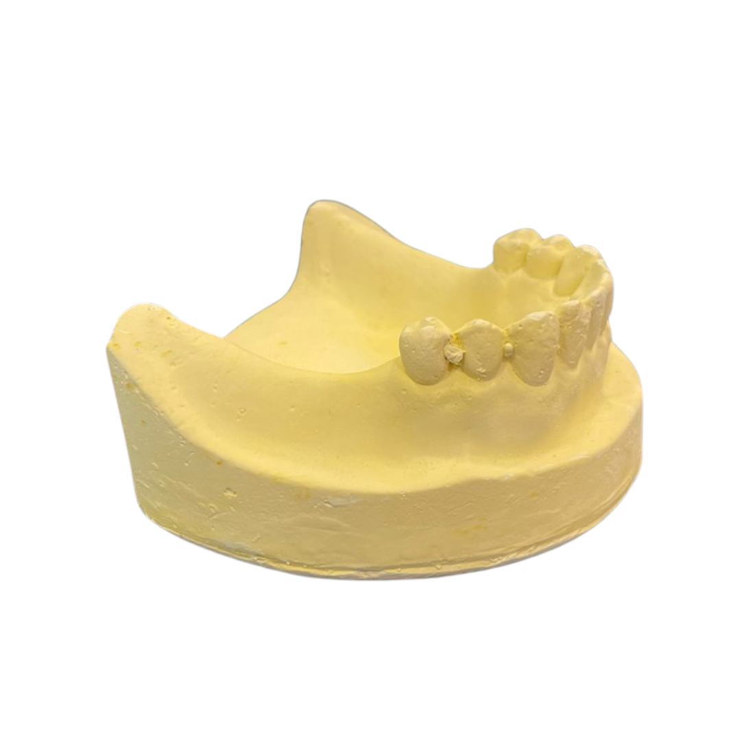 Class 1 No Modification Adult-Cast