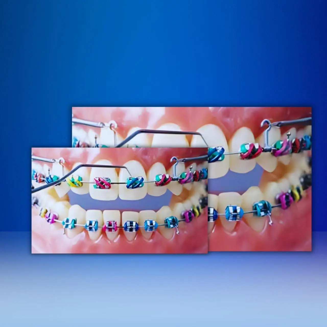 Colorful Braces Tableau