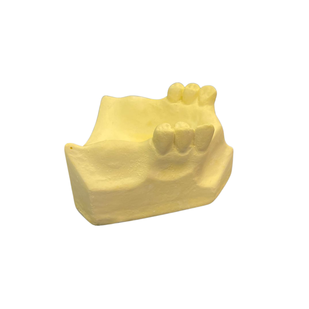 Class 1 Modification 1 Pedo-Cast