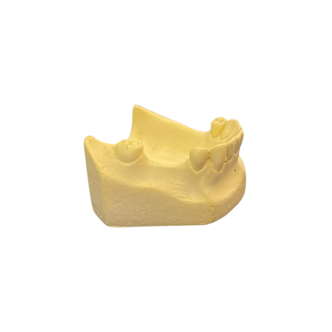 Class 2 Modification 1 Pedo-Cast